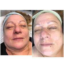 TOP 10 BEST Rhonda Allison in San Francisco, CA