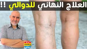 Check spelling or type a new query. Ø¥Ø°Ø§ ÙƒÙ†Øª ØªØ¹Ø§Ù†ÙŠ Ù…Ù† Ø§Ù„Ø¯ÙˆØ§Ù„ÙŠ ÙÙ‡Ø°Ø§ Ù‡Ùˆ Ø§Ù„Ø¹Ù„Ø§Ø¬ Ø§Ù„Ù†Ù‡Ø§Ø¦ÙŠ Ø§Ù„Ø·Ø¨ÙŠØ¹ÙŠ Ù…Ø¹ Ø§Ù„Ø¯ÙƒØªÙˆØ± ÙƒØ±ÙŠÙ… Ø§Ù„Ø¹Ø§Ø¨Ø¯ Ø§Ù„Ø¹Ù„ÙˆÙŠ Youtube