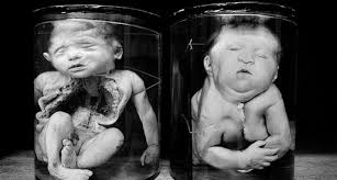 It is believed, that such effects of chernobyl mutations of fish were got thanks to often contact with the workers of the station. Chernobyl Mutations Animals And Humans Chernobyl Disaster