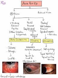 Image result for Acute Red Eye