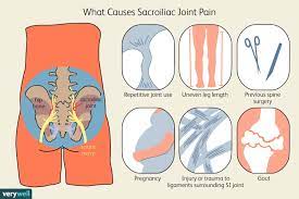Do you have low back pain? Sacroiliac Joint Pain Symptoms Causes And Treatment