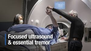 A tremor is most often in your hands, but it could also affect your arms, head, vocal cords, trunk, and legs. New Clinical Trial At Sunnybrook For Bilateral Essential Tremor Treatment With Focused Ultrasound Sunnybrook Research Institute