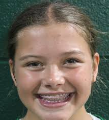 LITTLE LEAGUE SOFTBALL: Meet the Floyds Knobs Community Club 12U All-Stars 