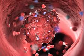 Maybe you would like to learn more about one of these? Blood Clots Extremely Common But Rarely Related To The Covid 19 Vaccine Patient Care