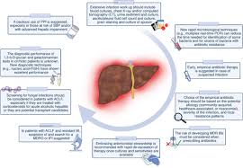 Liver disease management program