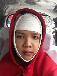 Cuộc sống cô gái 9X thay đổi sau phẫu thuật thẩm mỹ