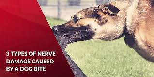 We did not find results for: Three Types Of Nerve Damage Caused By A Dog Bite Hupy And Abraham S C