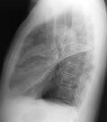 Chest Radiology