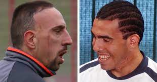 Carlos tevez is @bocajrsoficial's youngest and oldest goalscorer in the copa libertadores happy birthday to: How Did Franck Ribery And Carlos Tevez Get Their Permanent Scars I M A Useless Info Junkie