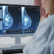 Image result for Inflammatory breast cancer