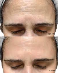 Vivant President Susan Fulton with her mother, Vivant Co-Founder and former  President Sara Fulton, in 2017. Two generations of women who have led  Vivant with vision and purpose since day one, keeping