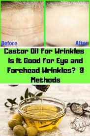 Castor Oil For Wrinkles Is It Good For Eye And Forehead Wrinkles 9 Methods Forehead Wrinkles What Causes Wrinkles Skin Cream Anti Aging