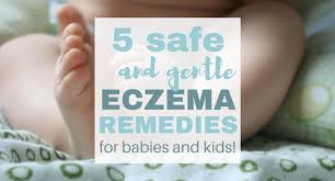8 fl oz (pack of 1). Baby Eczema Coconut Oil Treatment 4 More Natural Cures