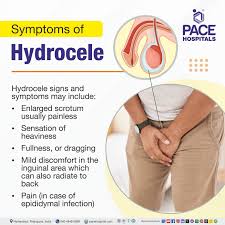 Image result for Scrotum