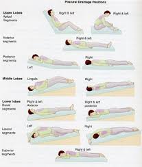 Pin By Melissa Gascon On Physical Therapy Notes Respiratory Therapy Respiratory Care Respiratory Therapist Student