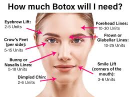 The areas on the face where botox can be injected are frown. Botox Cosmetic Albuquerque Best Wrinkle Reduction Santa Fe Skin Rejuvenation