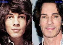 Chatter Busy Rick Springfield Surgery Rick Springfield Plastic Surgery Face Lift Surgery Plastic