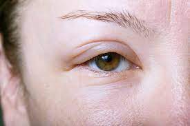 Reasons Why Your Face Looks Swollen