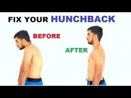 Youtube Posture Correction Workout Meal Plan Postures