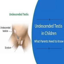 Image result for Undescended Testicle