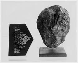 Women with womb cancer usually have a hysterectomy. Lithopedion Wikipedia
