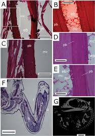 Woven bone is found on the growing ends of an immature skeleton or, in adults, at the site of a healing fracture. Ontogeny Of Hemidactylus Gekkota Squamata With Emphasis On The Limbs