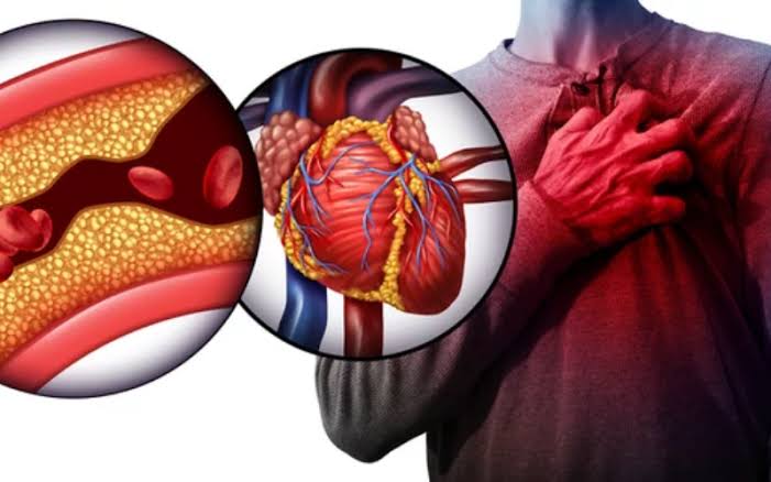 10 Biểu hiện của bệnh tim mạch dễ nhầm lẫn với các bệnh lý khác - Bệnh viện  FV
