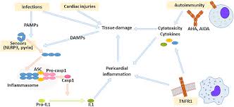 • symptoms of heart failure, • chest pain due to pericardial irritation • symptoms associated with heart block and arrhythmia. Frontiers Recurrent Pericarditis In Children And Adolescents Pediatrics
