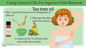 According to mayo clinic, there is a really easy ingrown hair remedy; How To Get Rid Of Ingrown Hair Razor Bumps Home Remedies Symptoms Removal Healthmd