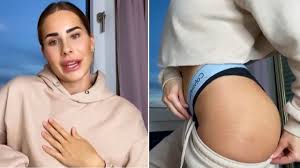Anahita rehbein offenbart ihre große problemzone. Video Dehnungsstreifen Und Cellulite Model Platzt Der Kragen Stern De