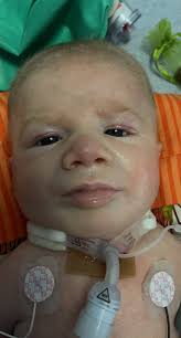 Colt Hughes just came out of surgery doing good