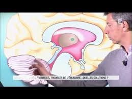 La asociación síndrome de ménière españa, asmes, nace con el objetivo de orientar y apoyar a las personas afectadas por esta enfermedad, respaldar la investigación y contribuir a un mayor. Allo Docteurs Parle De La Maladie De Meniere Youtube