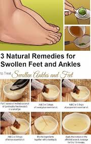 3 Natural Remedies For Swollen Feet And Ankles Try Some Of These Natural Remedies And Get Rid Of Swollen Fee With Images Foot Remedies Swollen Feet Remedy Natural Remedies