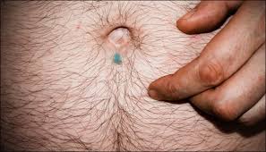 What exactly is belly button fluff? Sword Swallowers Belly Buttons And Flatulent Fish The Ig Nobel Prizes The Soft Anonymous