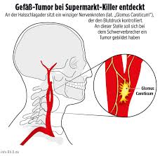 Er Versetzte Die Halbe Republik In Angst Jetzt Ist Er Schwer Krank Hals Tumor Supermarkt Killer Zittert Um Sein Leben Regional Bild De