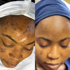 SKYN TOUCHÉ ( Formerly PREMIER PRETTY SKIN)