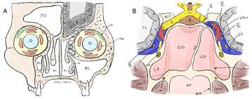 Image result for Sinusitis Prediction Rule