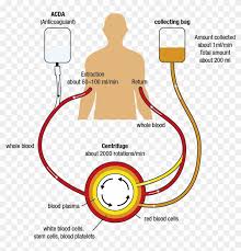 Fehler in verwendungsbeispielen zu „schaubild. Apherese Schaubild Apheresis Stem Cell Donation Hd Png Download 1754x1240 5136613 Pngfind