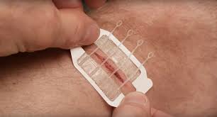 Pat the area dry with a soft towel. Zipstitch The Hospital Grade Wound Closure Device For Everyday Use