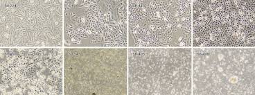 Establishment and characterization of primary lung cancer cell lines from  Chinese population | Acta Pharmacologica Sinica