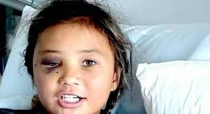 As a teenager, ferreira began uploading videos on myspace of herself singing songs she had written, which led to her discovery by producers bloodshy & avant and a recording contract with parlophone in 2009. Sky Brown Skatista De 11 Anos Sofre Grave Acidente Durante Manobra Assista O Video Gazeta Digital