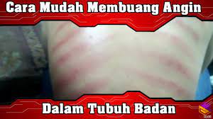 Jika ditangani dengan baik, penderita angin duduk dapat terhindar dari. Cara Mudah Membuang Angin Dalam Tubuh Badan Youtube