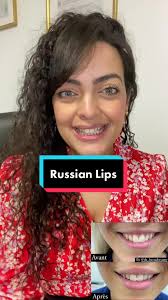 Dr Bernadette Ibrahim RussianLips #russianlips #medicine #injections...