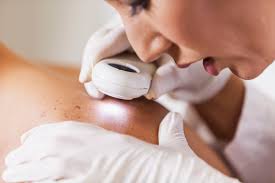 According to the american academy of … Skin Cancer Image Gallery Pictures And Photos