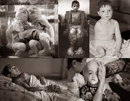 Ã§ernobil ile ilgili gÃ¶rsel sonucu