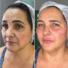 История торговой марки SachaJuan началась с создания в 1997 году в  Стокгольме сети салонов красоты. Основателями их стали парикмахеры-стилисты Sasha  Mitic и Juan Rosenlind, к тому времени уже зарекомендовавшие себя как  ведущие