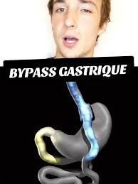 Retirer Une Sonde Naso Gastrique