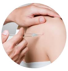 Image result for ultrasound guided injection