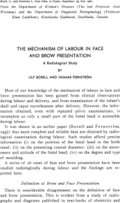 Image result for Brow Presentation