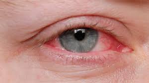 We did not find results for: Swollen Under Eye Causes Treatments And Home Remedies